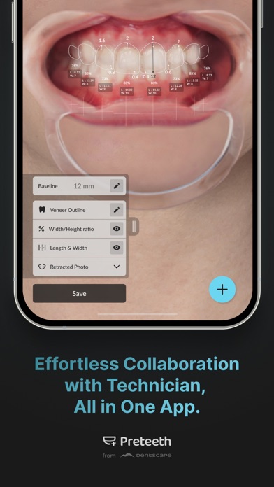 Preteeth AI Pro screenshot 1