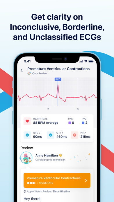 Qaly | ECG Reader screenshot 2