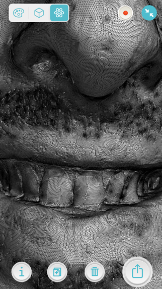 Qlone Dental Pro 3D Scanner screenshot 1