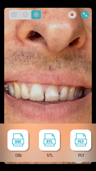 Qlone Dental Pro 3D Scanner screenshot 2
