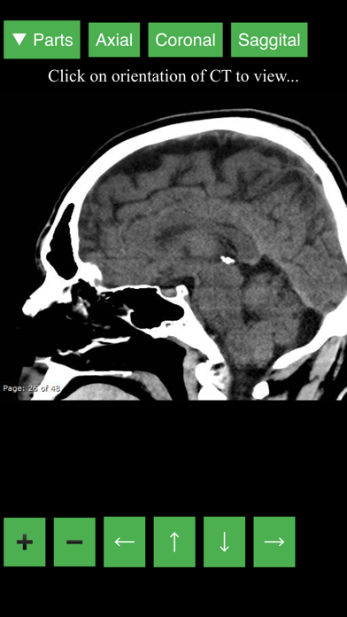 Radiology CT Viewer screenshot 4