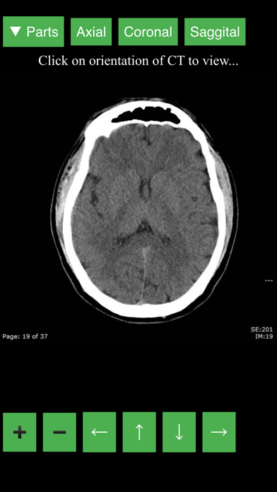 Radiology CT Viewer screenshot 5