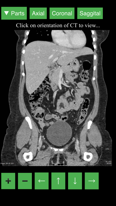 Radiology CT Viewer screenshot 1