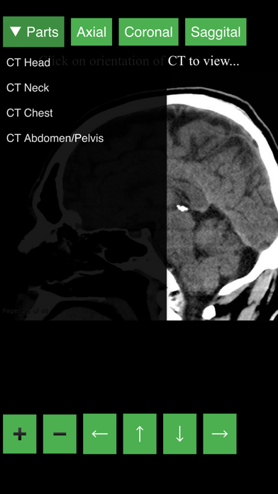 Radiology CT Viewer screenshot 2