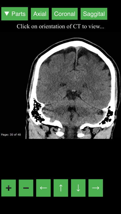 Radiology CT Viewer screenshot 3