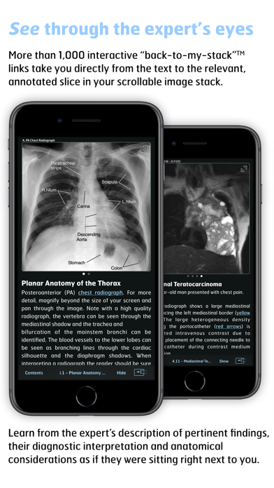Radiology - Thoracic Imaging screenshot 2