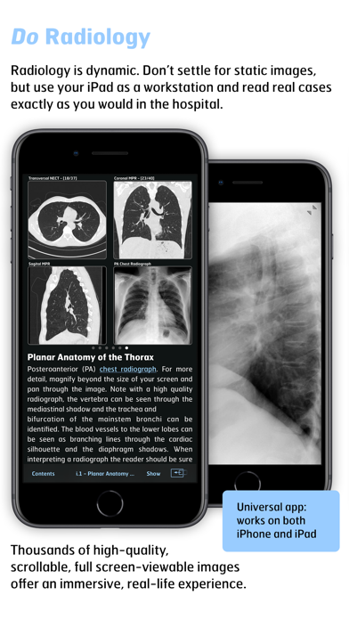 Radiology - Thoracic Imaging screenshot 3