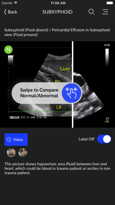 RESUS Ultrasound screenshot 5