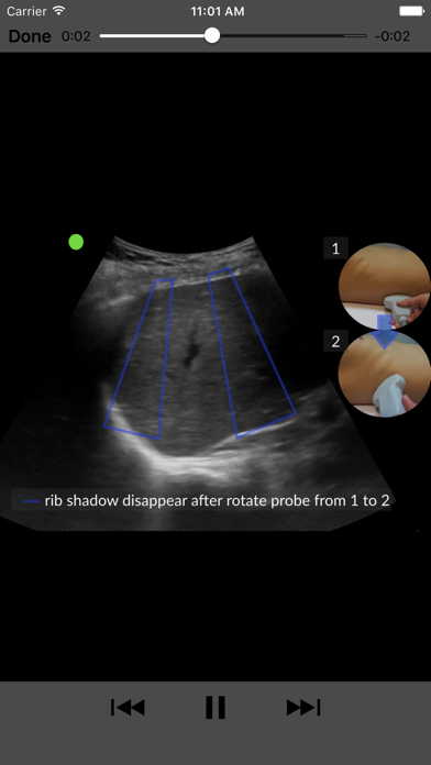 RESUS Ultrasound screenshot 3