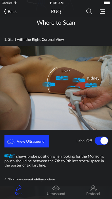 RESUS Ultrasound screenshot 4