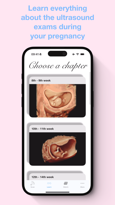 ScanBaby learn baby ultrasound screenshot 2