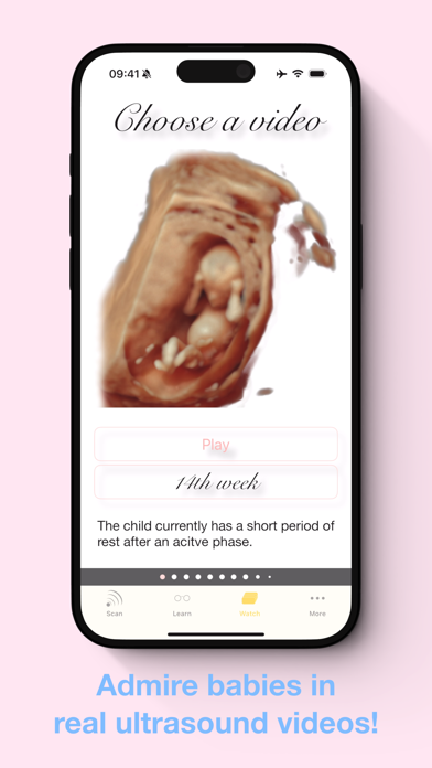 ScanBaby learn baby ultrasound screenshot 1