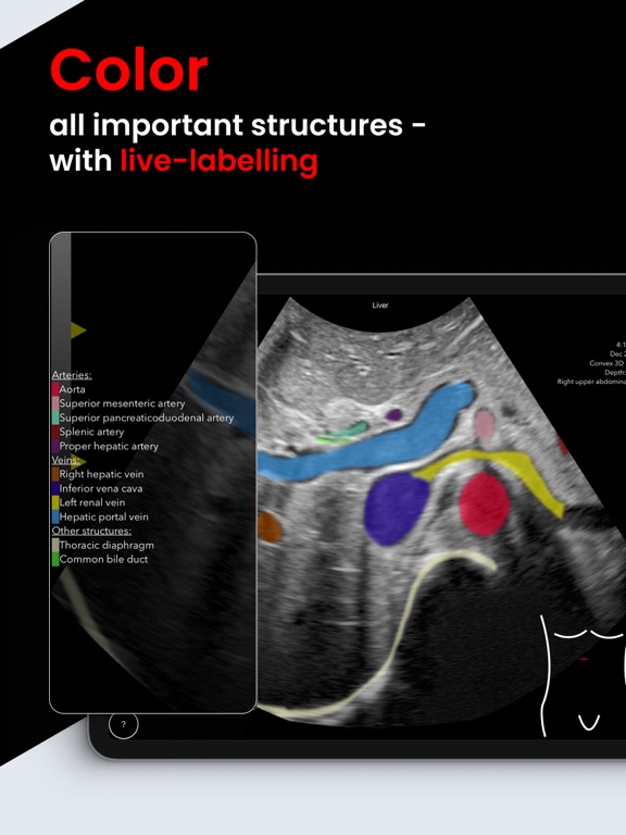 Scanbooster Ultrasound Sim screenshot 5