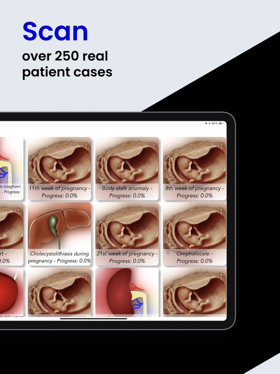 Scanbooster Ultrasound Sim screenshot 6
