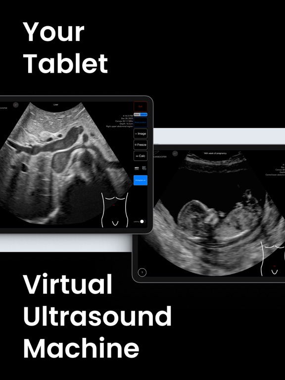 Scanbooster Ultrasound Sim screenshot 7