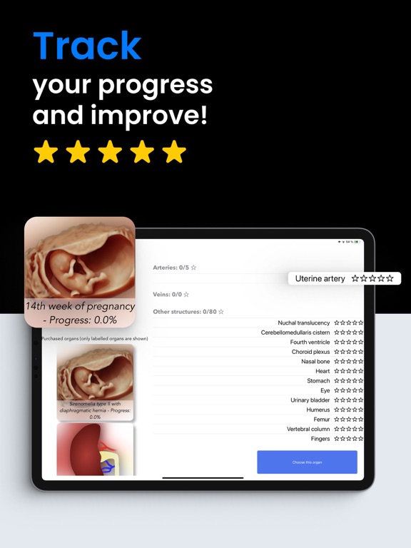 Scanbooster Ultrasound Sim screenshot 4