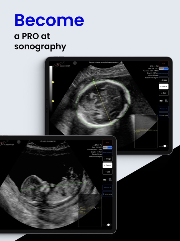 Scanbooster Ultrasound Sim screenshot 2