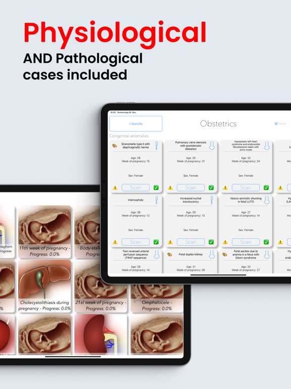 Scanbooster Ultrasound Sim screenshot 3