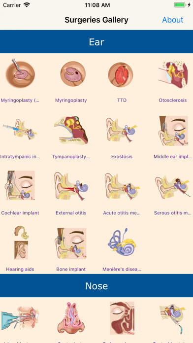 SeeENT screenshot 3