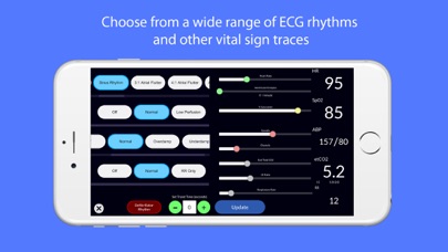Simpl Patient Monitor screenshot 1