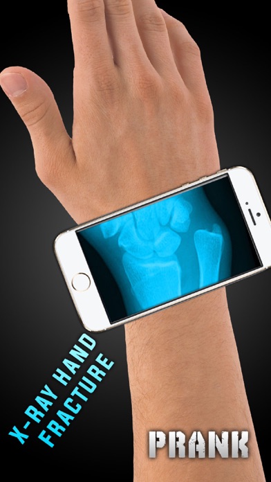 Simulator X-Ray Hand Fracture screenshot 2