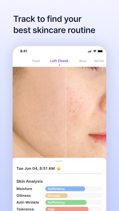 Skinlog | Acne diary screenshot 2