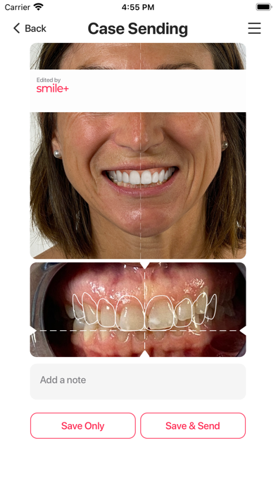 Smile+ screenshot 2