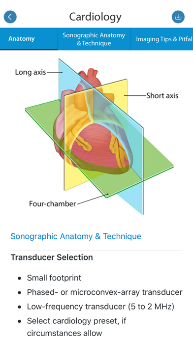 SonoSim screenshot 4
