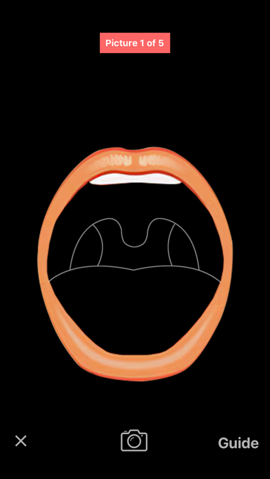 StrepApp screenshot 6