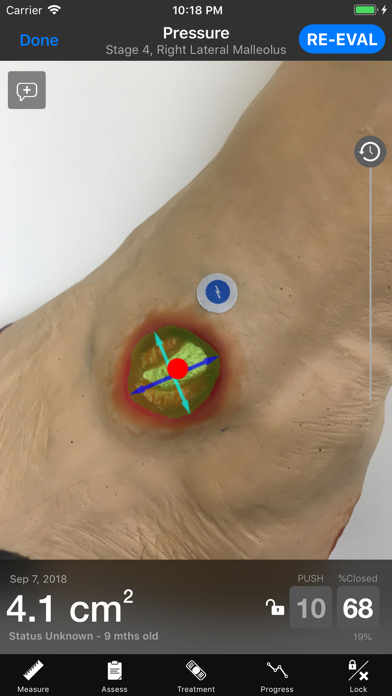 Swift Skin and Wound screenshot 1