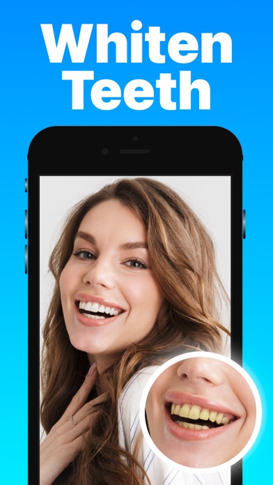 Teeth Whitener & Whitening screenshot 5