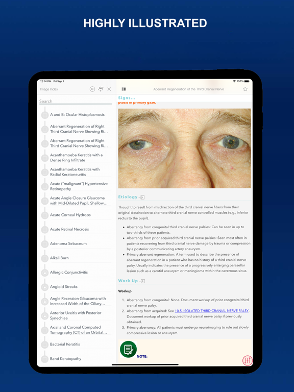 The Wills Eye Manual screenshot 3