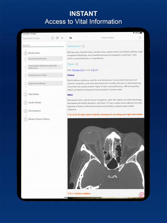 The Wills Eye Manual screenshot 6