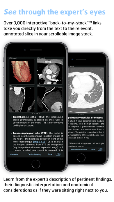 Thoracic Imaging Fundamentals screenshot 2