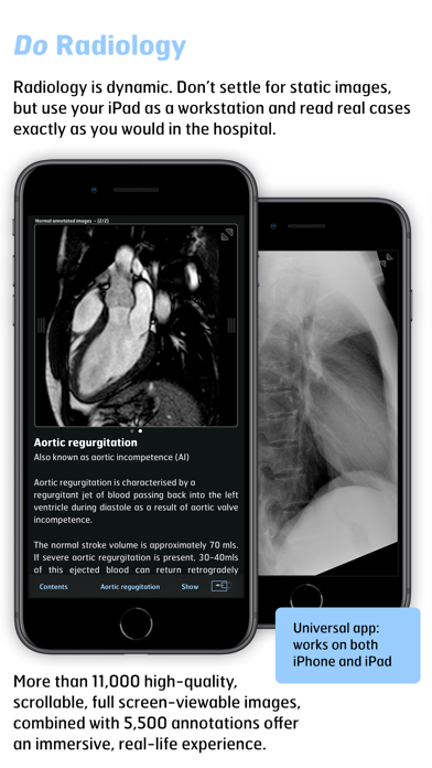 Thoracic Imaging Fundamentals screenshot 3