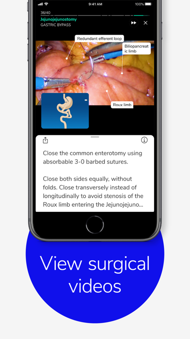 Touch Surgery: Surgical Videos screenshot 2
