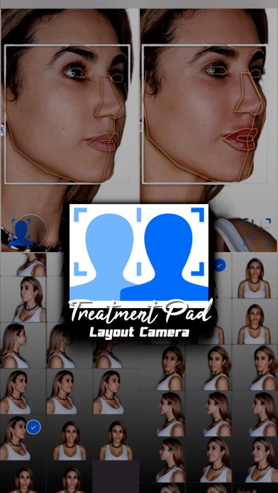 Treatment Pad AI Layout Camera screenshot 1