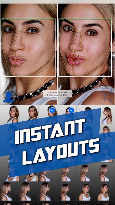 Treatment Pad AI Layout Camera screenshot 2