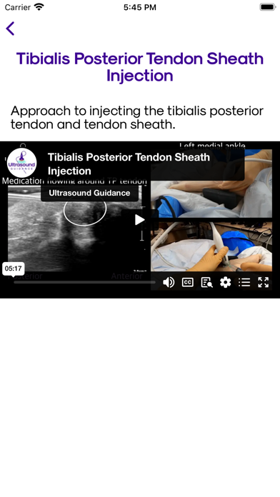 Ultrasound Guidance screenshot 3