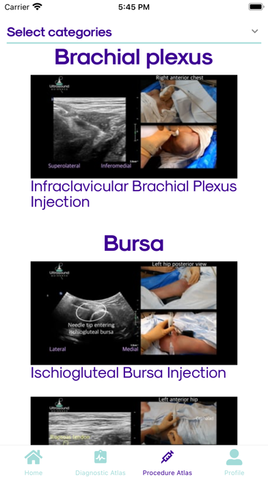 Ultrasound Guidance screenshot 2