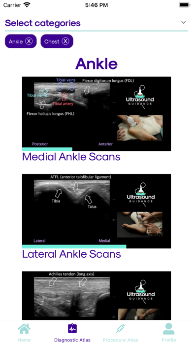Ultrasound Guidance screenshot 1