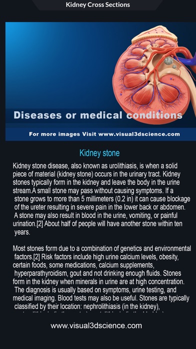 Urinary System screenshot 1