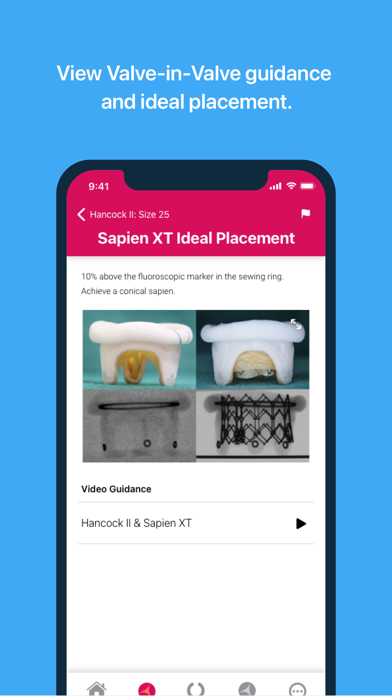 Valve In Valve (Mitral) screenshot 3