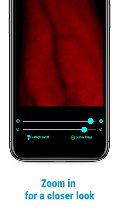 VeinScanner screenshot 1
