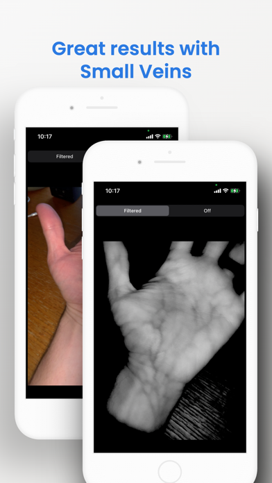 VeinSeek Pro screenshot 1