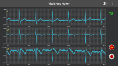 VitalSign Holter screenshot 2