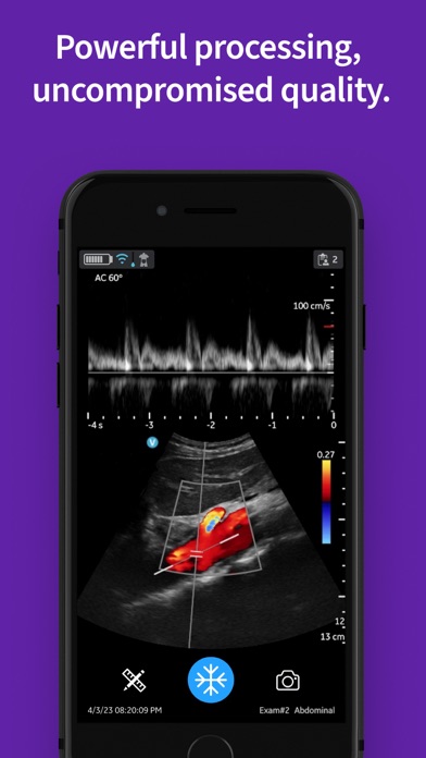 Vscan Air Wireless Ultrasound screenshot 2