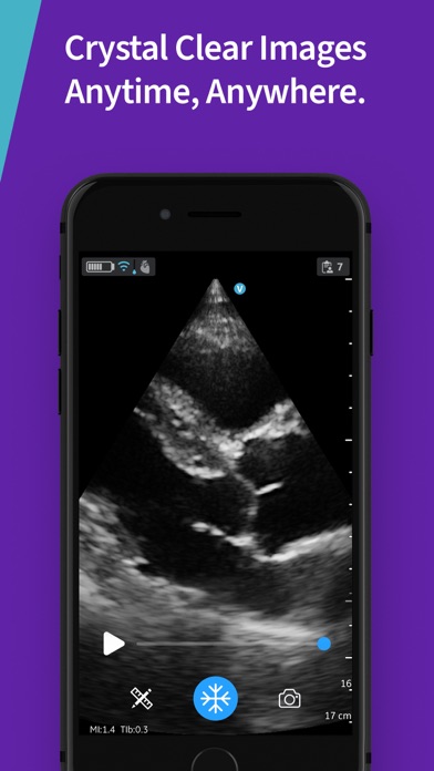 Vscan Air Wireless Ultrasound screenshot 4