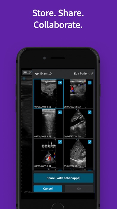 Vscan Air Wireless Ultrasound screenshot 3