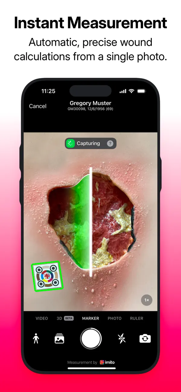 WoundGenius - The Wound App screenshot 4